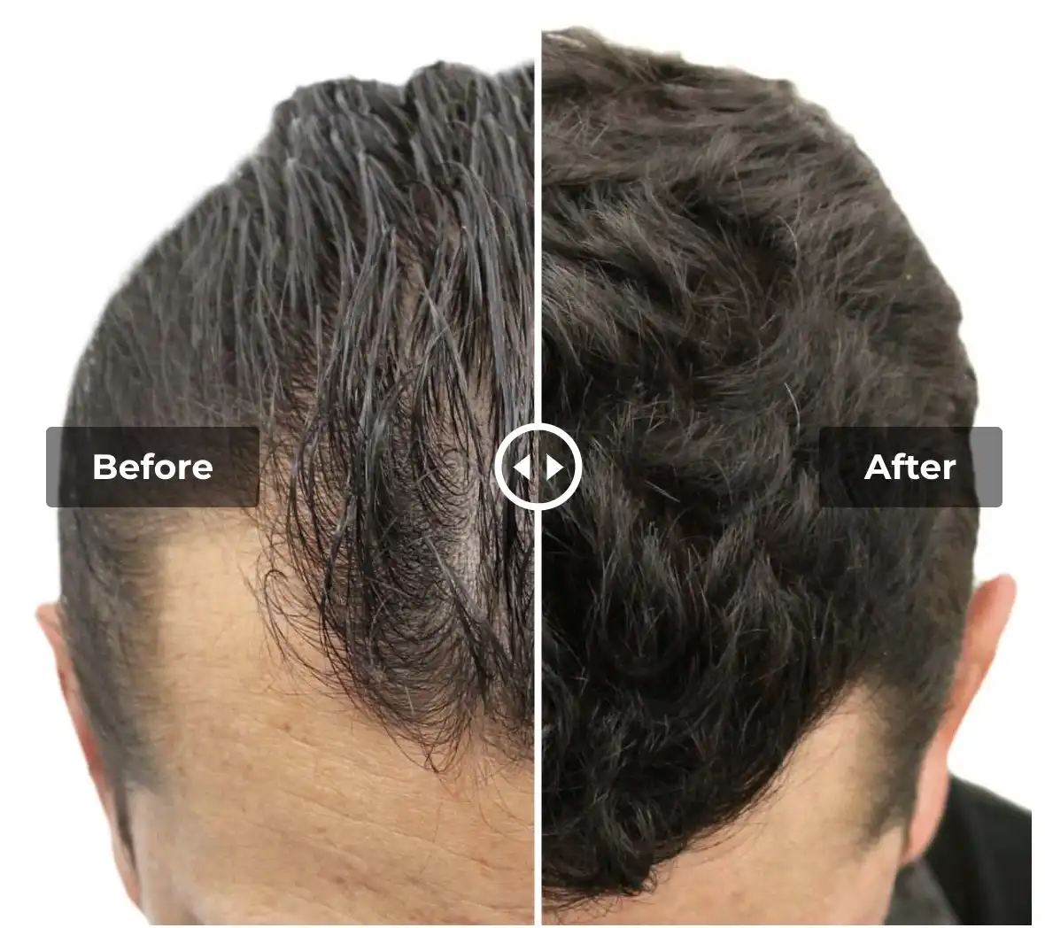 Antes y Despues de una restauración capilar.